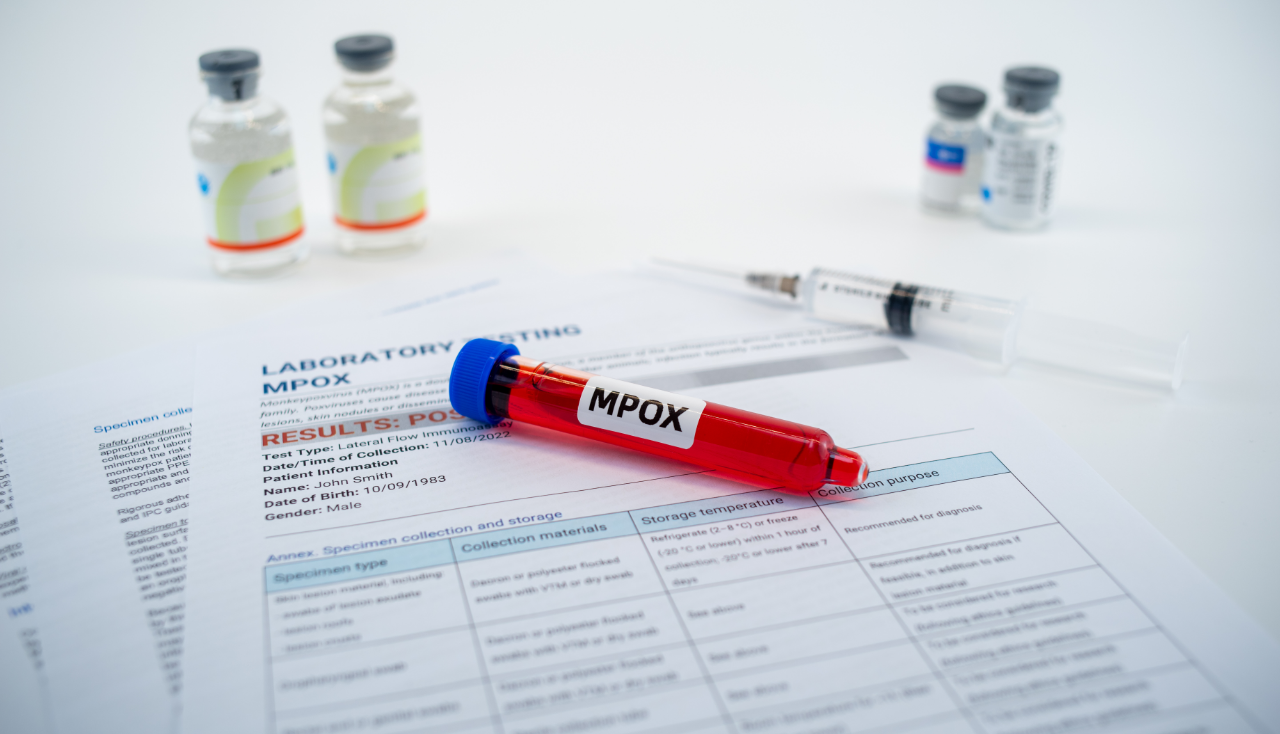 mpox, meymun çiçəyi, PCR testi, yanlış diaqnoz, Konqo Demokratik Respublikası, virus, yoluxucu xəstəlik, tibbi araşdırma